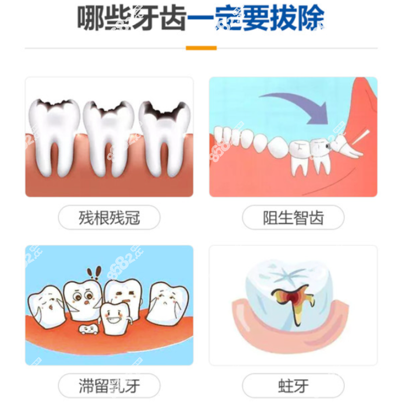 北海拔智齿去哪个医院