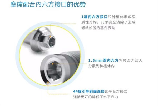 美国杰美种植体和以色列mis的区别是什么