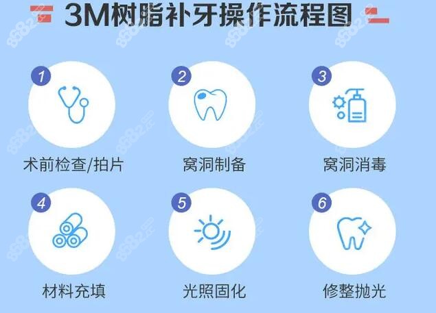 美国3M纳米树脂补牙操作流程