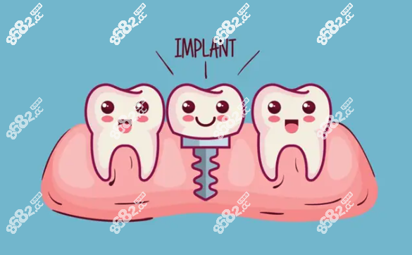 到底要不要做种植牙手术