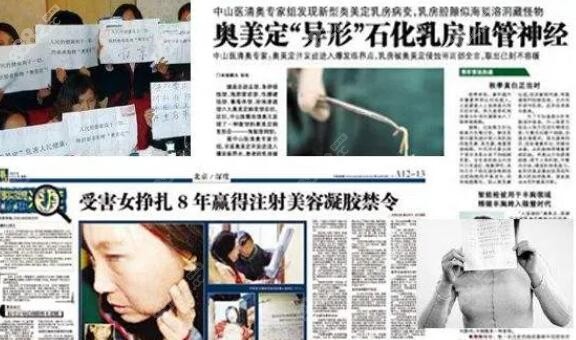 奧美定注射的危害