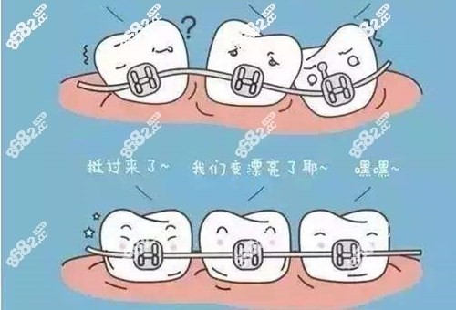 厦门牙齿矫正哪家好呢？
