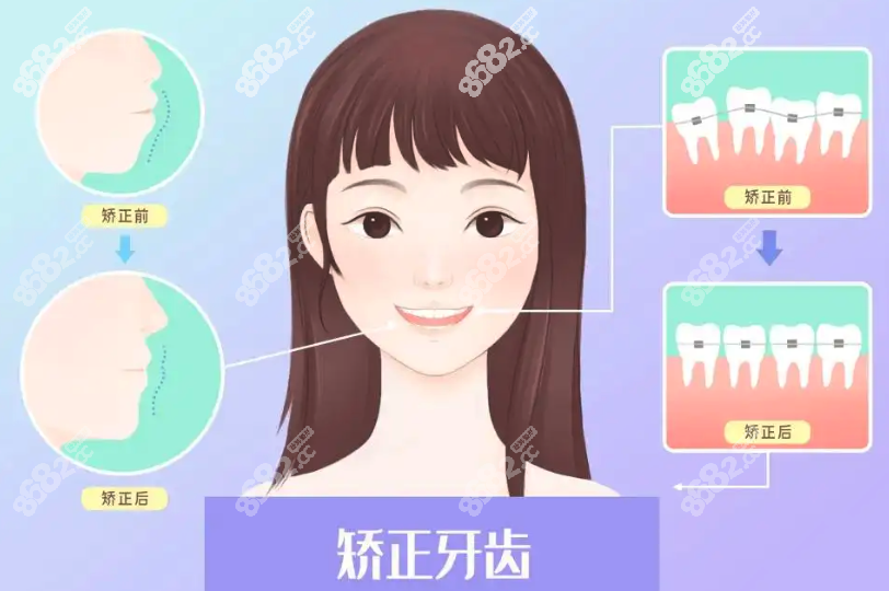 西安矫正牙齿性价比高的医院有谁