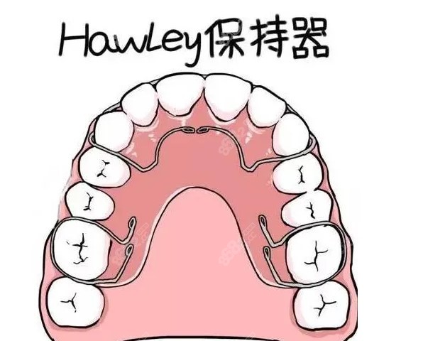 隐适美需要一直戴保持器吗