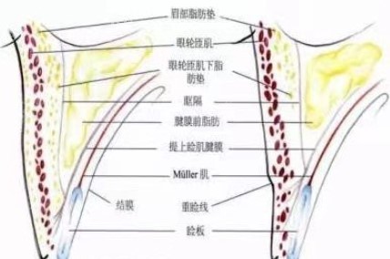史迎军修复双眼皮怎么样？