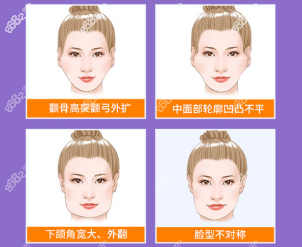 宁波磨骨瘦脸手术多少钱