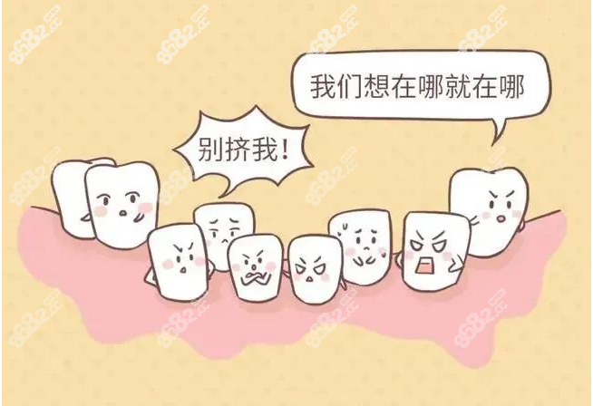牙齿不齐拥挤示意图