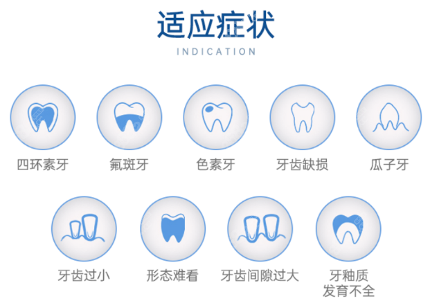 牙贴面材料种类、价格及适应症状