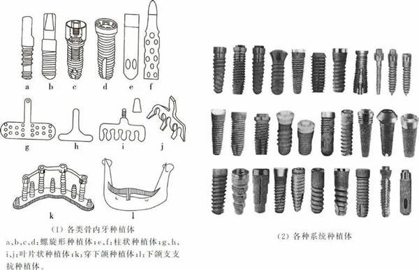 国产威高和韩国登腾植体对比