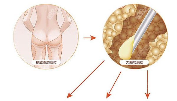 维密脂雕