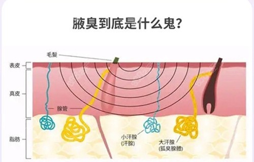 长沙去狐臭