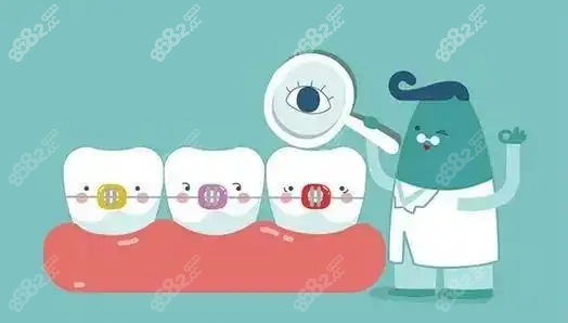 北京金属托槽矫正牙齿多少钱