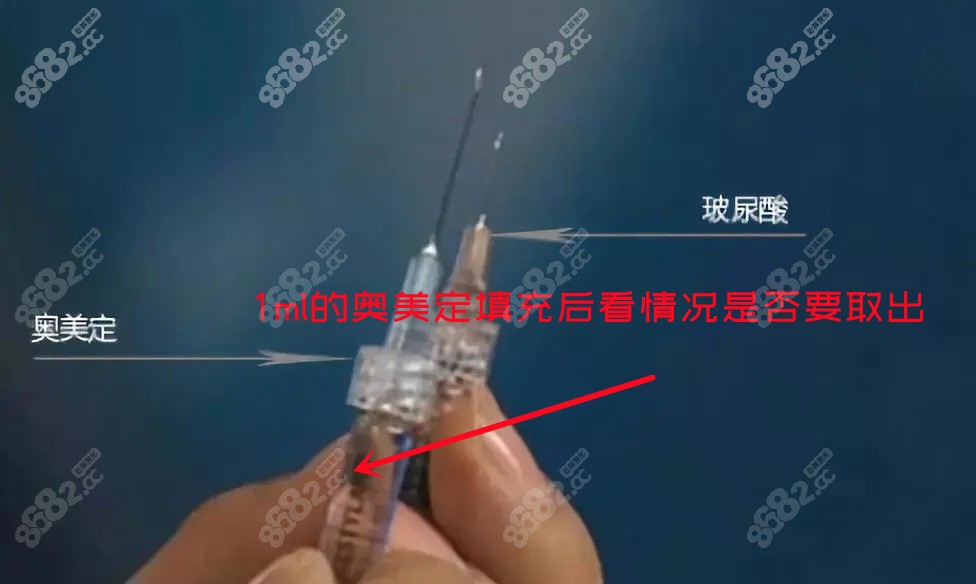 奥美定和玻尿酸的注射针头是不一样的