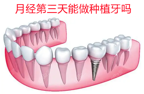 月经第三天能做种植牙吗