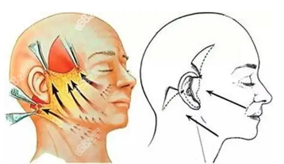 韓國(guó)拉皮手術(shù)醫(yī)院做得好的醫(yī)院 韓國(guó)拉皮手術(shù)醫(yī)院做得好的醫(yī)院