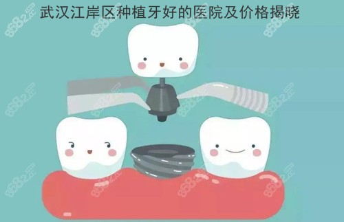 武汉江岸区种植牙的医院合集