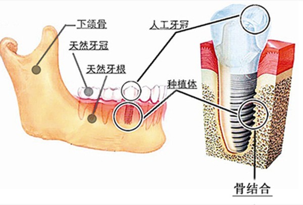 牙齿在牙槽骨内的图