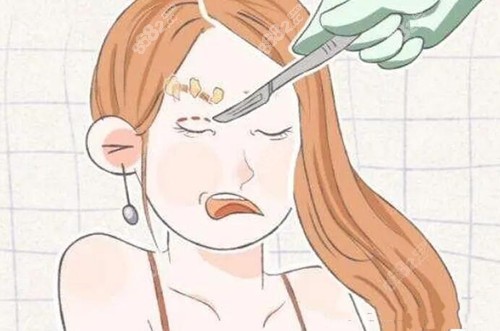 www.8682.cc提供的孝感华美双眼皮修复技术图