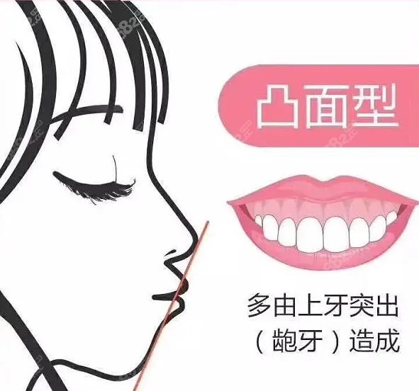 烟台开发区口腔医院牙齿矫正多少钱