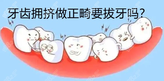 牙齿拥挤做正畸要拔牙吗