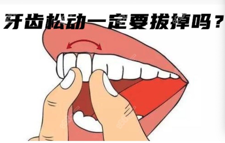 牙齿松动了要拔掉吗