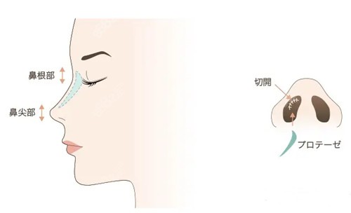 做鼻子