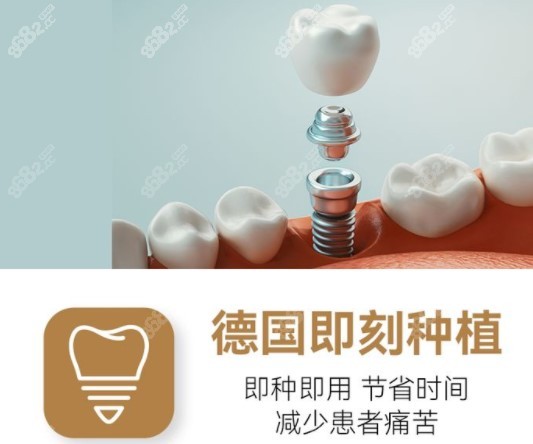 广州柏德口腔种牙优势