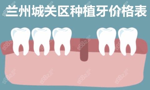 兰州城关区种植牙价格表