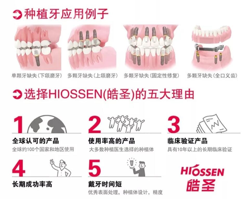 重庆长寿区欧美种植牙品牌收费标准