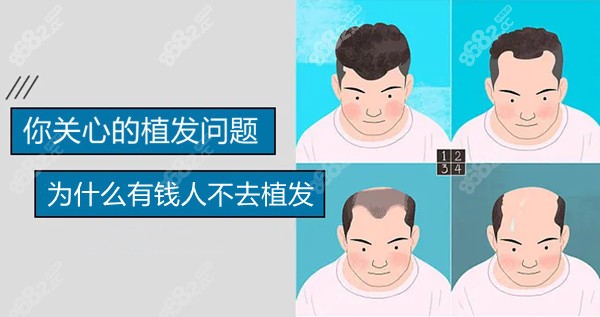 为什么有钱人不去植发