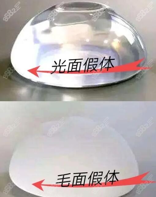 假体取出技术好的医院