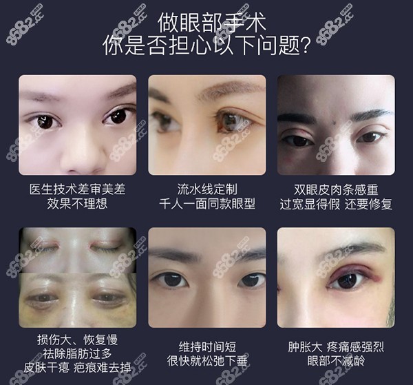 眼部整形担心问题