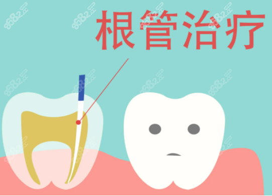 4岁小孩根管治疗后悔怎么回事