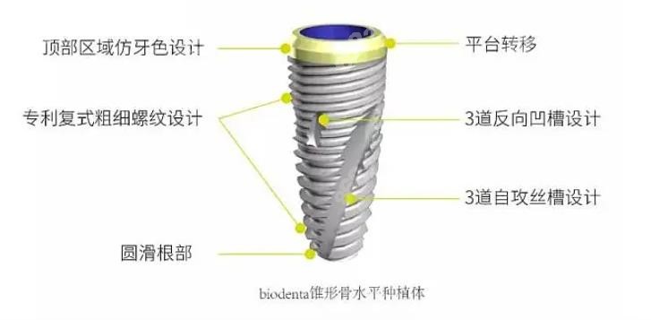 瑞士百丹特植体外观