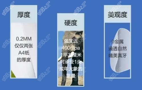 美加牙齿贴面特征