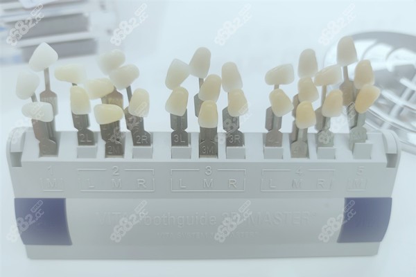 萧山牙科医院哪家好价格实惠-鼎植口腔