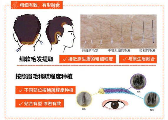 纹眉和种植眉毛的区别