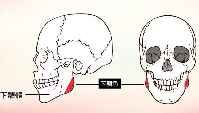 下颌角整形手术位置