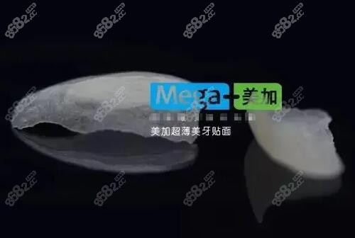 美加超薄牙齿贴面