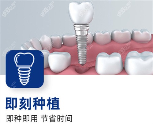 牙知道口腔即刻种植