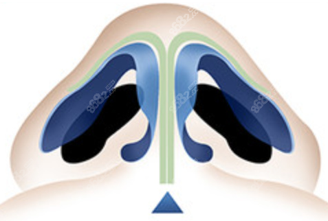 上海華美謝衛(wèi)國做鼻子怎么樣