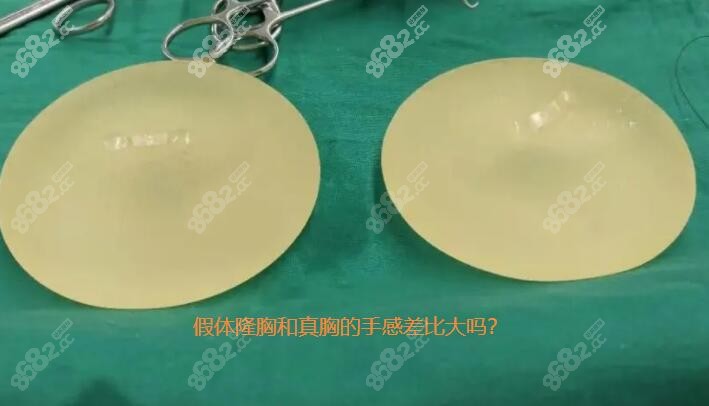现在很多人对自己身材要求越来越高了，身材匀称还要有胸器，因此这几年吸脂和隆胸项目火热，不少人想要隆胸但是却怕隆胸不好，想知道假体隆胸和真胸的手感差别大吗?复合隆胸和假体隆胸哪个好？