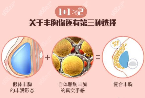 复合隆胸的优势
