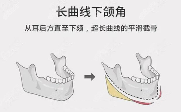 方脸削骨方法