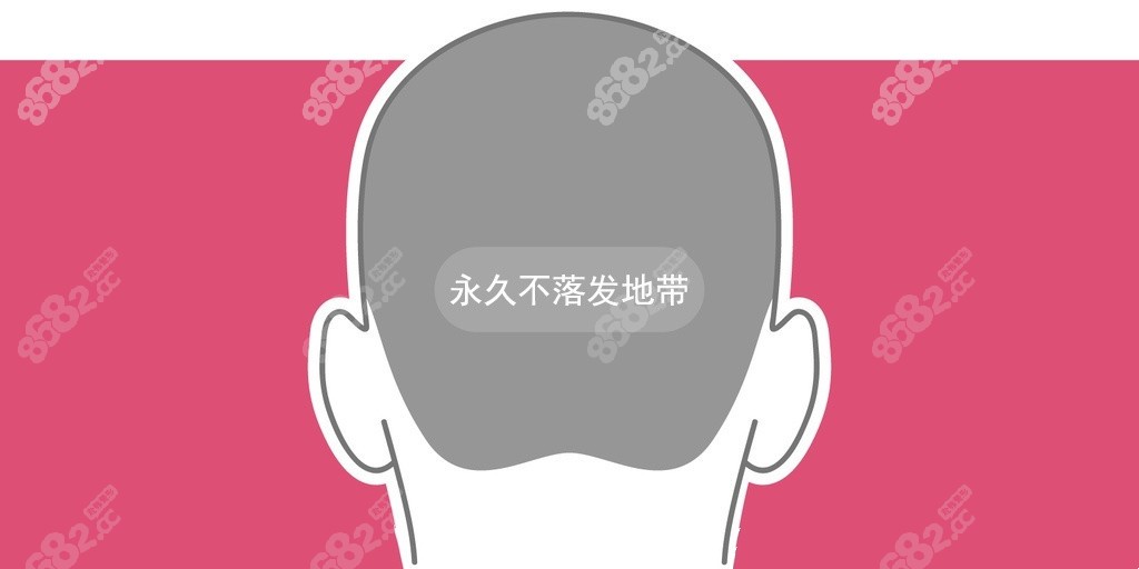 二次加密也要看后枕部资源支持不