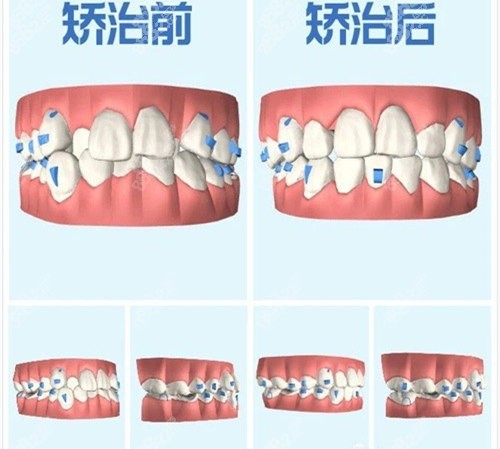 上海悦康口腔