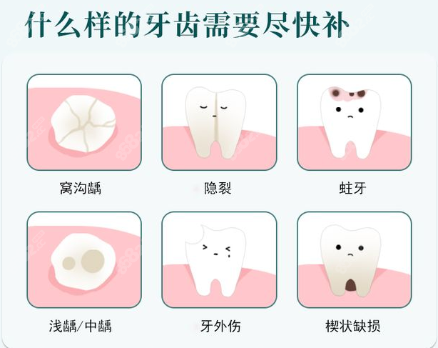 什么样的牙齿需要尽快补