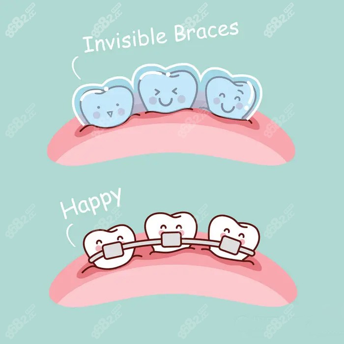 厦门牙齿隐形矫正哪家好