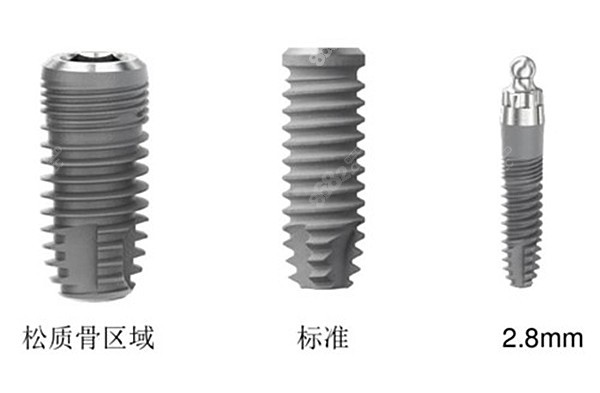 设计特点不同