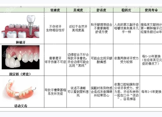 种植牙和其他固定义齿等的对比